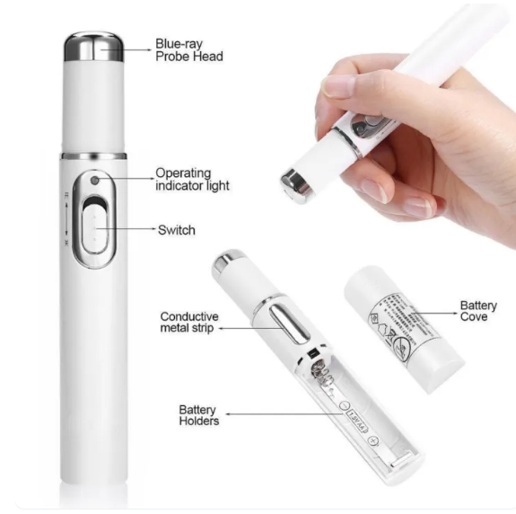 Tratamiento para Varices – Mejora Circulación en Piernas